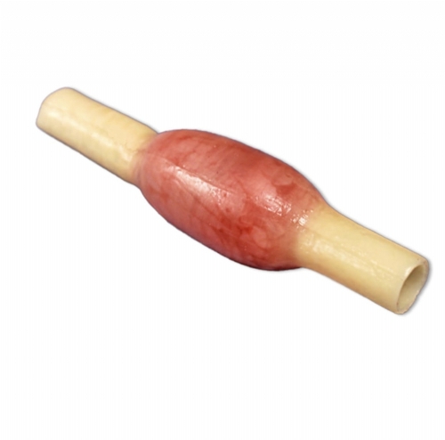 Ectopic Pregnancy Model | OB-GYN Surgical Training Simulator